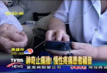 神奇止痛機　慢性疼痛患者福音