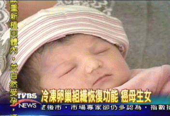 冷凍卵巢組織恢復功能 癌母生女