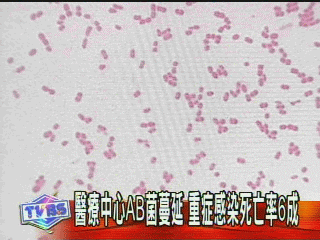 醫療中心AB菌蔓延 重症感染死亡率6成