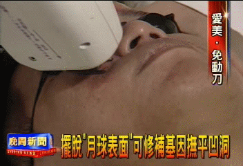 擺脫「月球表面」　可修補基因撫平凹洞