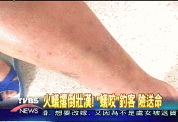 火蟻撂倒壯漢！「蟻咬」釣客　險送命