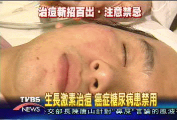 生長激素治痘 癌症糖尿病患禁用