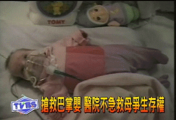 搶救巴掌嬰 醫院不急救母爭生存權
