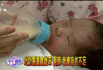 吐奶嚴重會變笨 醫師:營養吸收不足