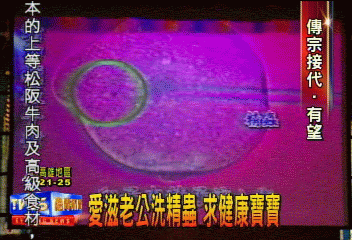 愛滋老公洗精蟲　求健康寶寶