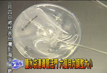 新隆乳術 變大變小自己決定