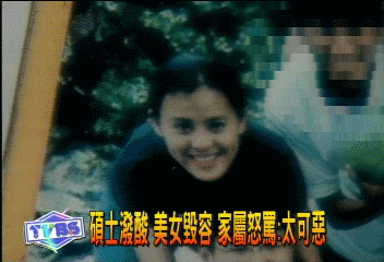 碩士潑酸　美女毀容　家屬怒罵：太可惡