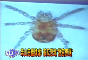 柴山恙蟲肆虐! 被咬恐致「器官衰竭」