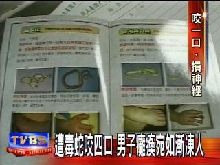 毒蛇咬四口　男子癱瘓如漸凍人