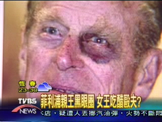 菲利浦親王「熊貓眼」 摔跤?被毆?