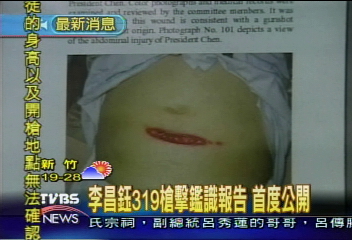 319槍案　李昌鈺槍擊報告公佈上網
