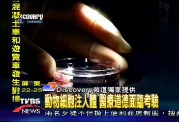 聽障兒童福音 人工器官改善聽力