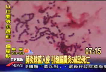 肺炎球菌入侵 引發腦膜炎5成恐死亡