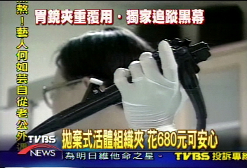 〈獨家〉美國2000年規定　使用拋棄式活體組織夾