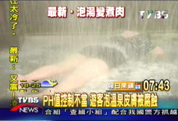 溫泉SPA太酸 起70幾個水泡