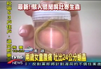 2歲女童腹痛　吐出24公分蛔蟲