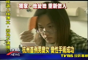 〈獨家〉杭州首例男變女 變性手術成功