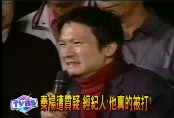 秦楊遭質疑　經紀人︰他真的被打！