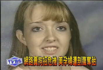 網路賣狗陷危境 美孕婦遭剖腹奪胎
