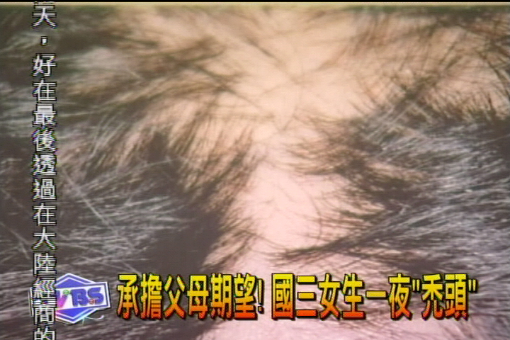 承擔父母期望！　國三女生一夜「禿頭」