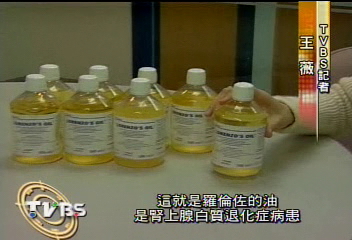 〈獨家〉「羅倫佐的油」 台大有成功救活案例