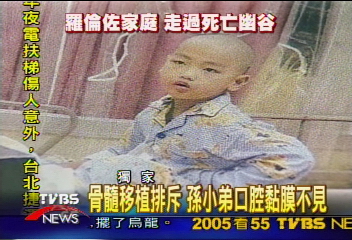 〈獨家〉ALD骨髓配對移植 嚴重排斥奪性命