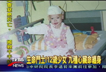 生命鬥士!12歲少女 9種心臟命纏身