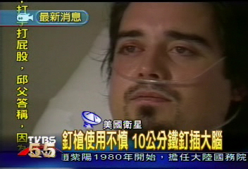 10公分鐵釘插頭顱 照X光才發現