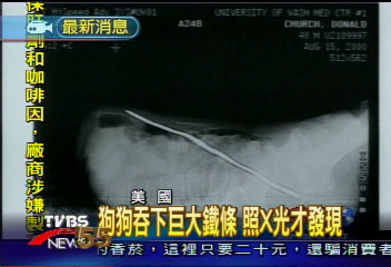 離奇! 美婦人頸部中刀 渾然不覺