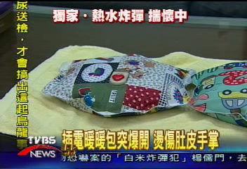 〈獨家〉插電暖暖包突爆開　燙傷肚皮手掌