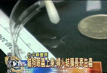 貓狗眼蟲上身　婦人結膜長寄生蟲
