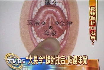 「大長今」蜂針扎舌　恢復味覺