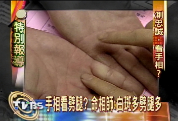 從手相看劈腿? 命相師:白斑多劈腿多