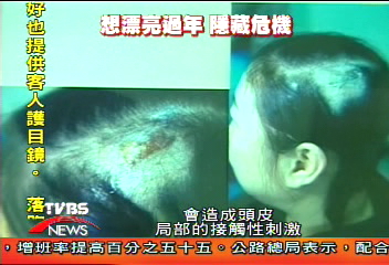 妙齡模特兒染髮 媽呀!禿頭險瞎