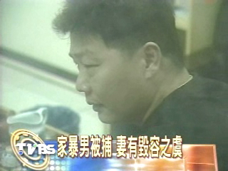 懷疑外遇　丈夫潑妻子硫酸！
