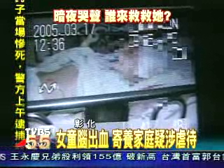 女童腦出血 疑寄養家庭虐待