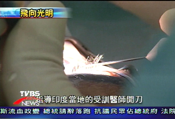 【飛向光明,讓印度看見】16歲印度少年 重見光明全紀錄