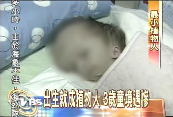 〈獨家〉我要活下去！　最小植物人　小傑待援