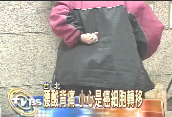 腰酸背痛 小心是癌細胞轉移