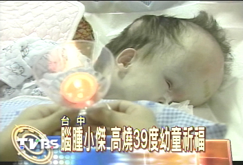 腦腫小傑　高燒39度幼童祈福