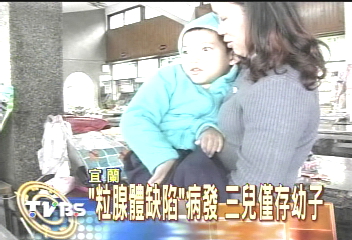 「粒腺體缺陷」病發 三兒僅存幼子