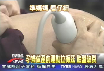 孕婦做產前運動拉梅茲　胎盤破裂