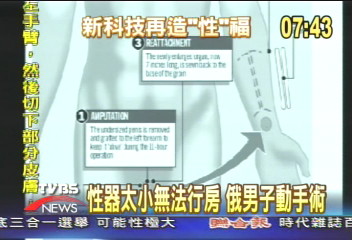手臂種陰莖變長 重振男性雄風