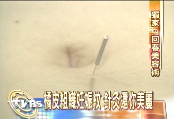 請問消除橘皮組織的中醫診所？
