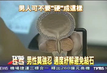 男性莫強忍　適度紓解避免結石