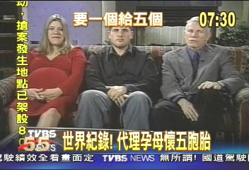 人工受精 美代理孕母懷五胞胎