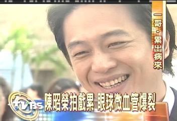 陳昭榮拍戲累　眼球微血管爆裂