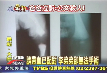 等不到公文　大理石寶寶快瞎了