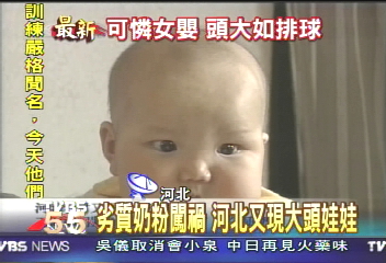 劣質奶粉闖禍　河北又現大頭娃娃