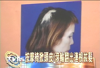 按摩椅掀頭皮!滾輪翻出連根拔髮